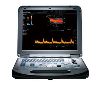 便携式彩色多普勒超声系统M55