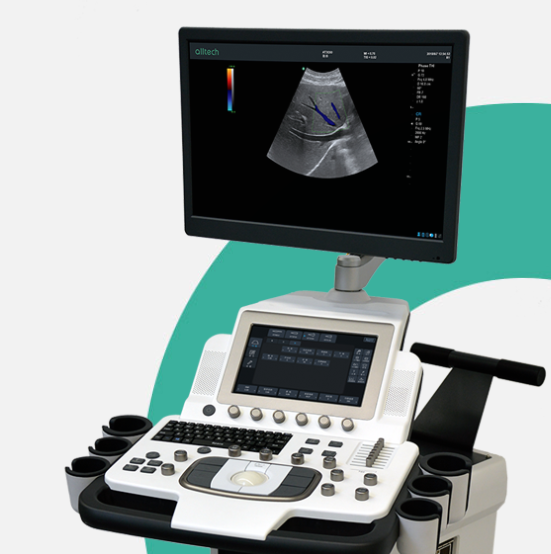 全数字彩色多普勒超声诊断系统A8 S