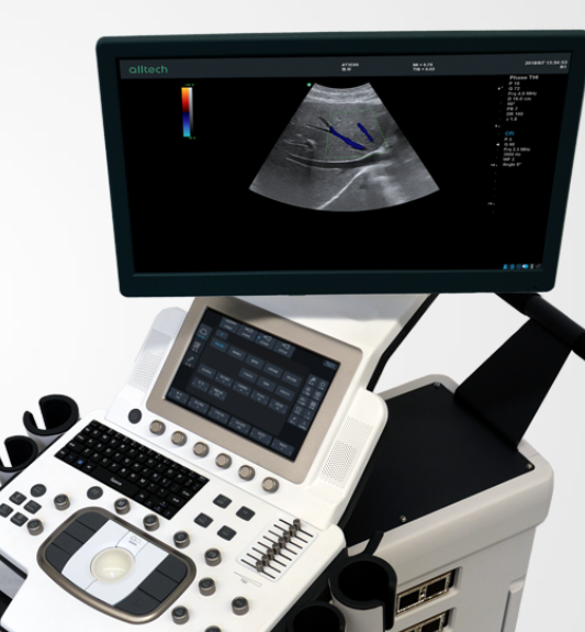 全数字彩色多普勒超声诊断系统A8