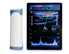 掌上彩色多普勒超声诊断仪iM10C-3