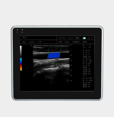 平板式全数字彩色多普勒超声诊断系统mEye1
