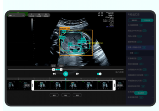 产前动态超声影像处理系统AiriScan T6